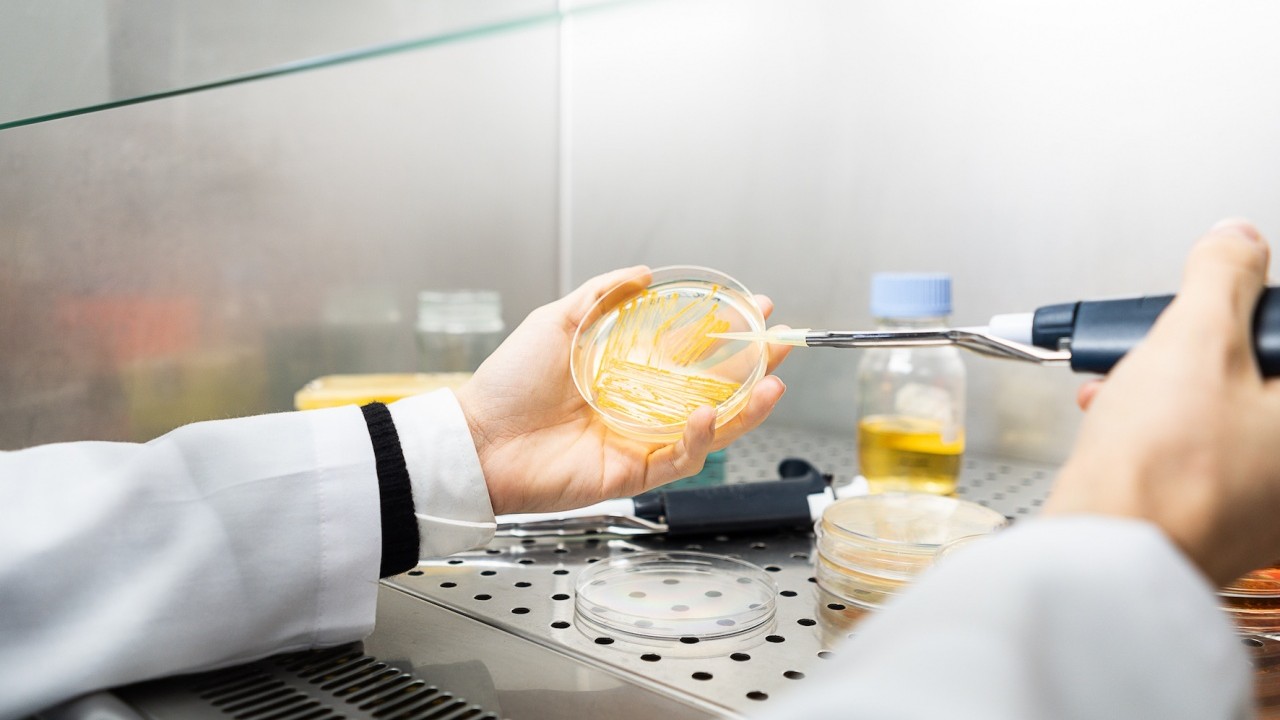 "Micro-Val": batteri mangia-plastica per riciclare i rifiuti organici